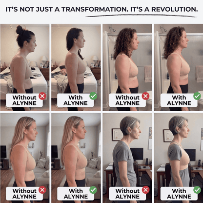 NOKOOLA 3D Posture Bra